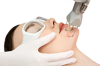 Fractional Laser Resurfacing
